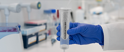 Retos del ADN plasmídico utilizado en aplicaciones biofarmacéuticas y terapia génica