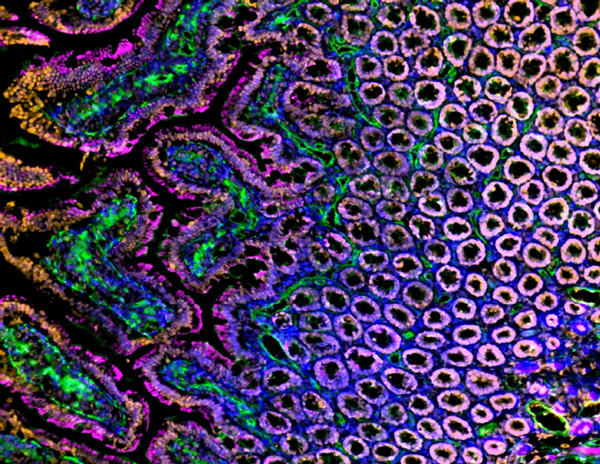 Análisis inmunofluorescente de secciones congeladas de intestino de rata Sprague Dawley, duodeno, con Histona H3 (naranja), vasos sanguíneos (lectina, verde), actina (magenta) y núcleos (azul)